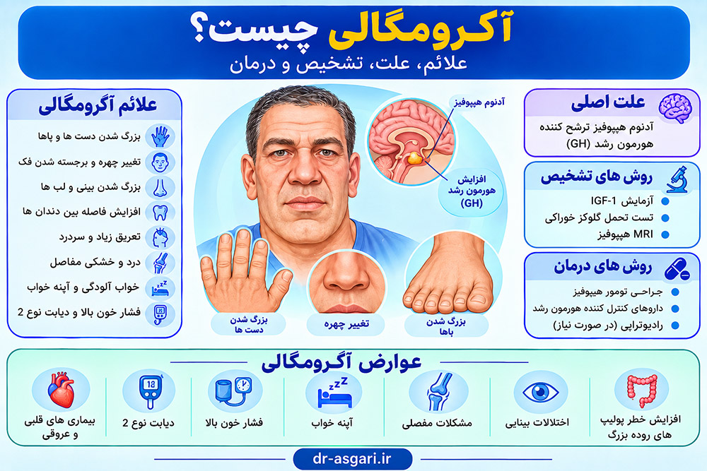 آکرومگالی چیست؟ علائم، علت، تشخیص و درمان