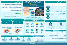 سلای خالی (Empty Sella) چیست؟ علائم، علل و درمان