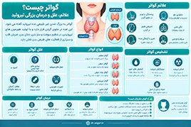 گواتر چیست؟ علائم، علل و درمان بزرگی تیروئید