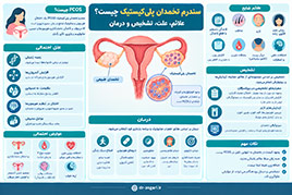 سندرم تخمدان پلی کیستیک چیست؟ علائم، علت، تشخیص و درمان