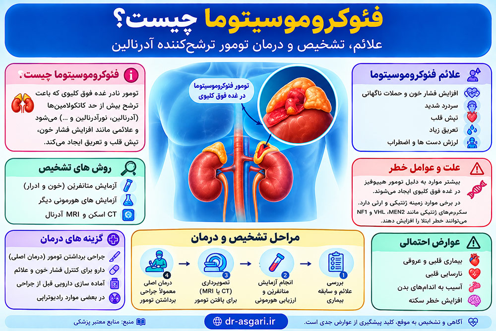 فئوکروموسیتوما چیست؟ علائم، تشخیص و درمان